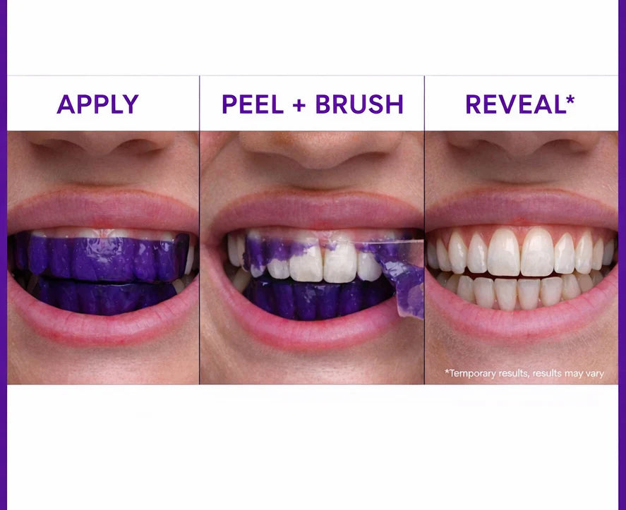 Purple Whitening Strips™