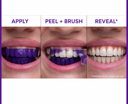 Purple Whitening Strips™